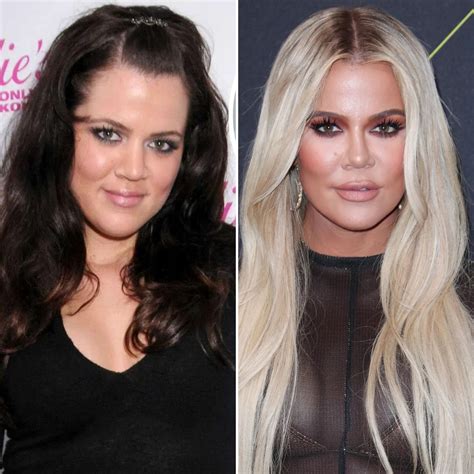 chloe k|khloe Kardashian before and after.